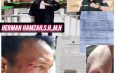 HERMAN HAMZAH, S.H., M.H. Siap Kawal Hukum, Suami Korban Pemilik HP Dikeroyok & Dilempar Batu,