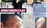 HERMAN HAMZAH, S.H., M.H. Siap Kawal Hukum, Suami Korban Pemilik HP Dikeroyok & Dilempar Batu,
