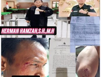 HERMAN HAMZAH, S.H., M.H. Siap Kawal Hukum, Suami Korban Pemilik HP Dikeroyok & Dilempar Batu,